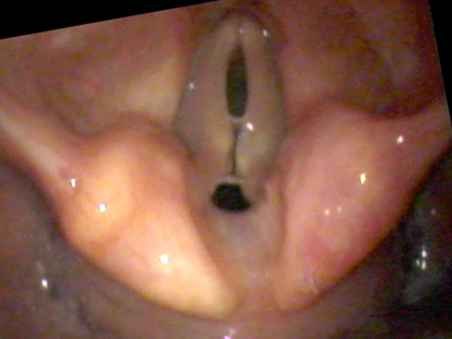 Bowed cords at low pitch with large air gap