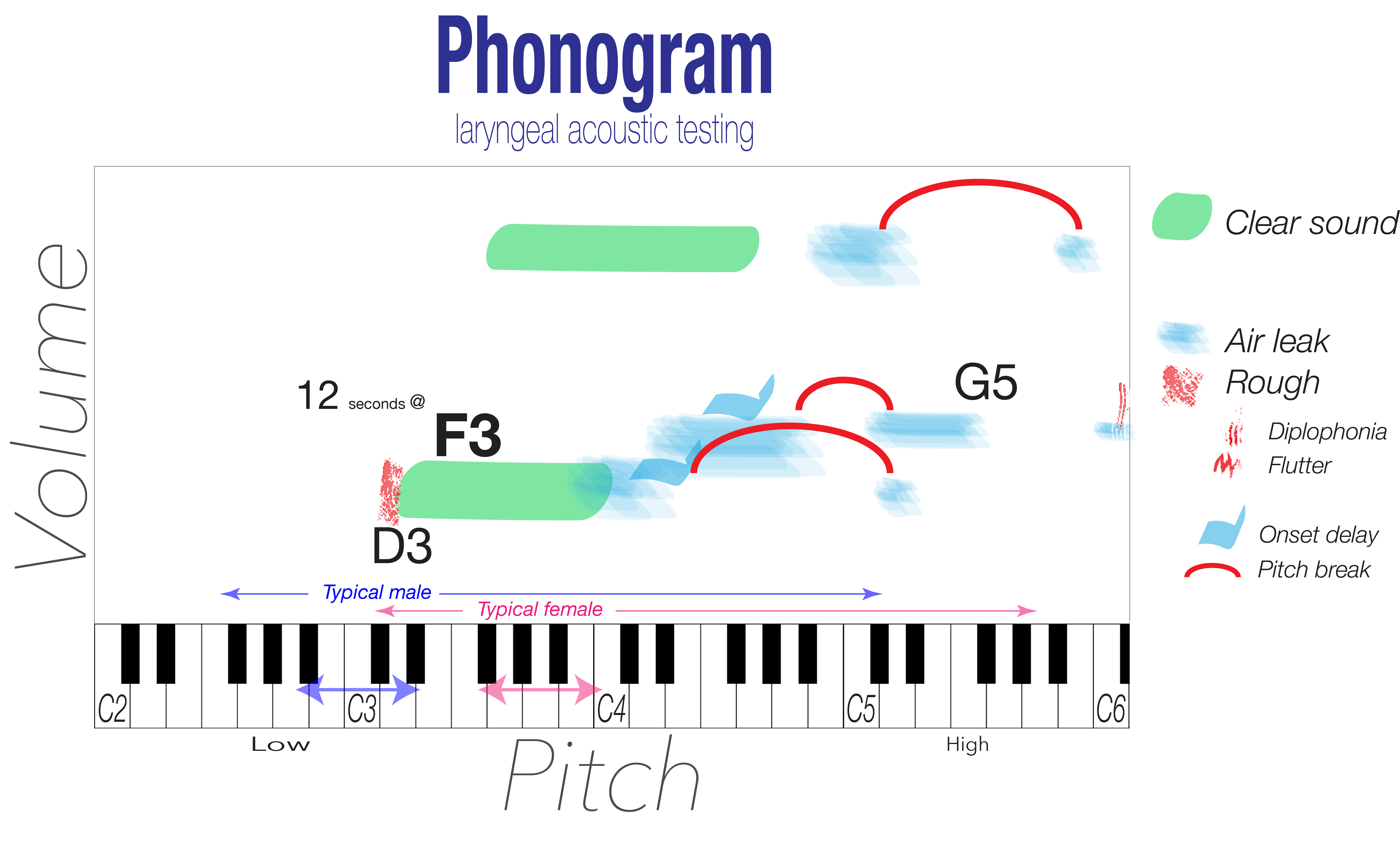 Vocal capabilities phonogram depicting abnormal voice qualities