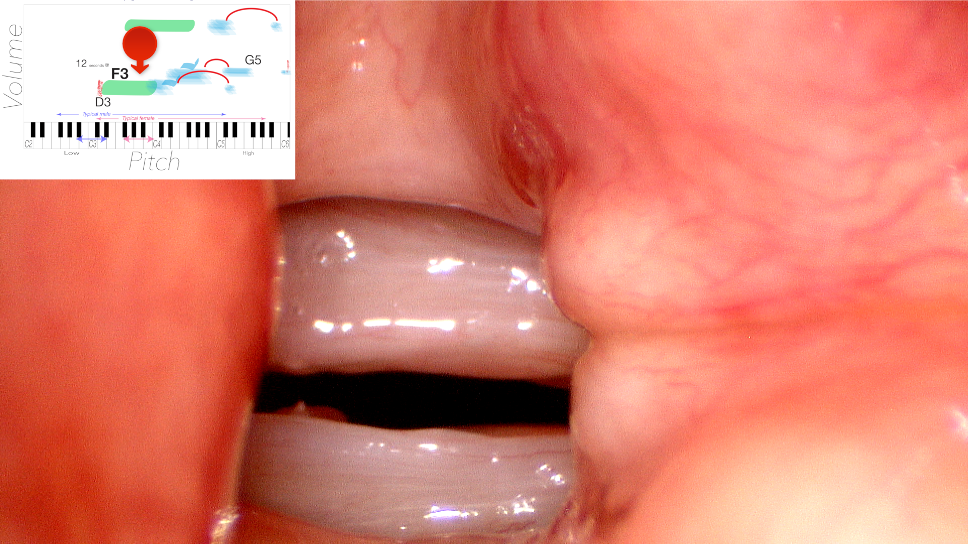 At the low pitch of A3 the vocal cord swellings do not touch firmly enough to stop vocal cord oscillation
