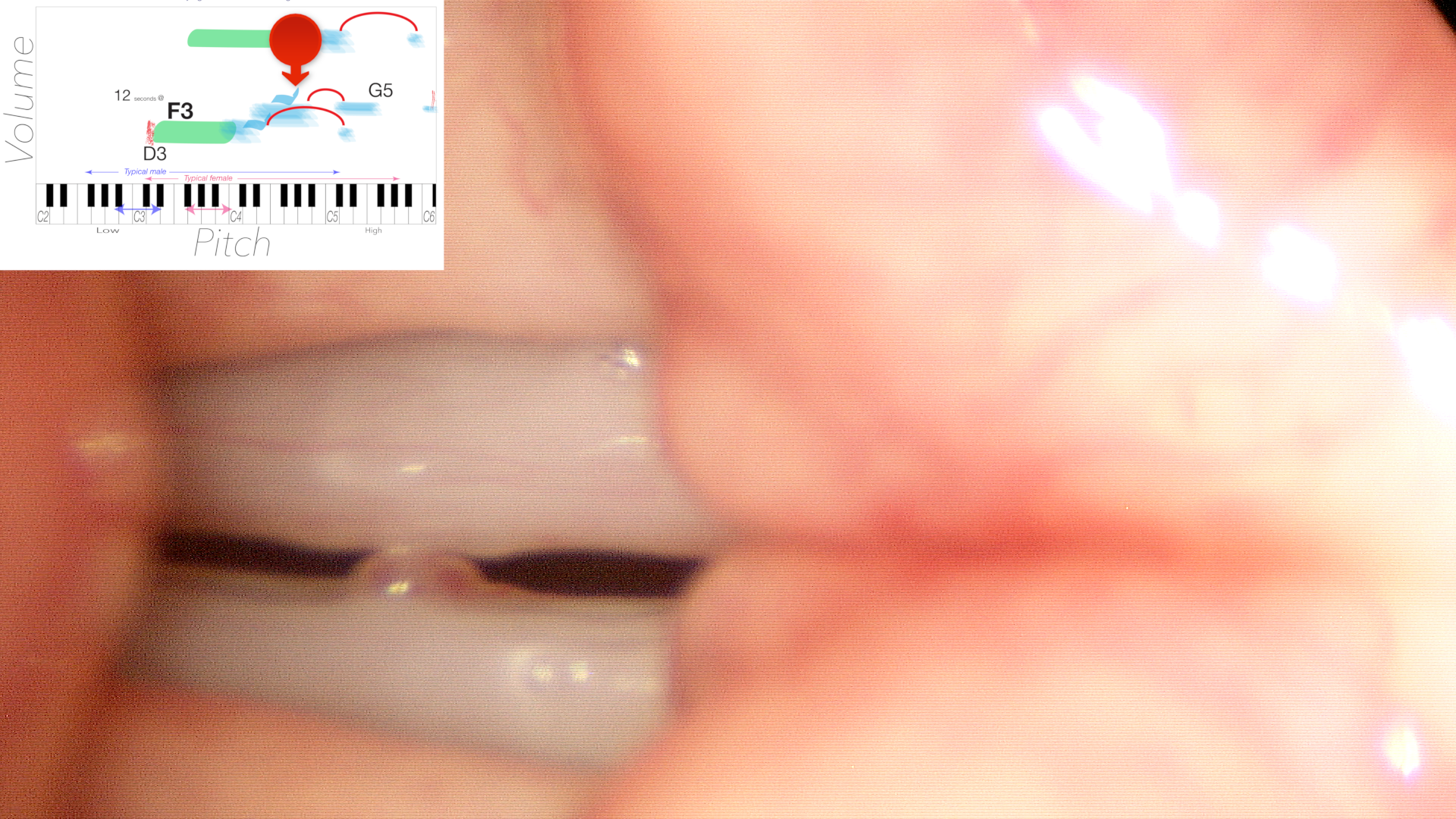 At pitch G4 the vocal swelling continuously touches the opposite side causing an onset delay or pitch break