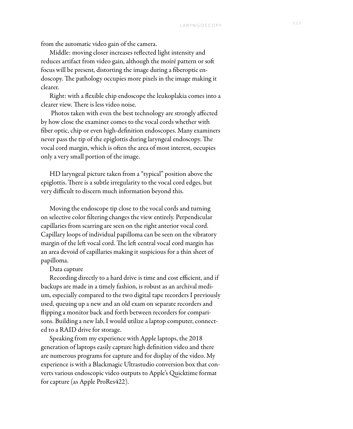 HD laryngeal view from above epiglottis versus close-up with selective color showing scar capillaries and papilloma loops