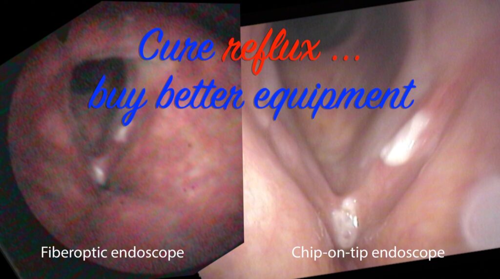 The same larynx photographed with a fiberoptic endoscope and with a chip-on-tip endoscope. The fiberoptic view is hazy and red; the chip-on-tip view resolves the mucosa clearly and the redness disappears.